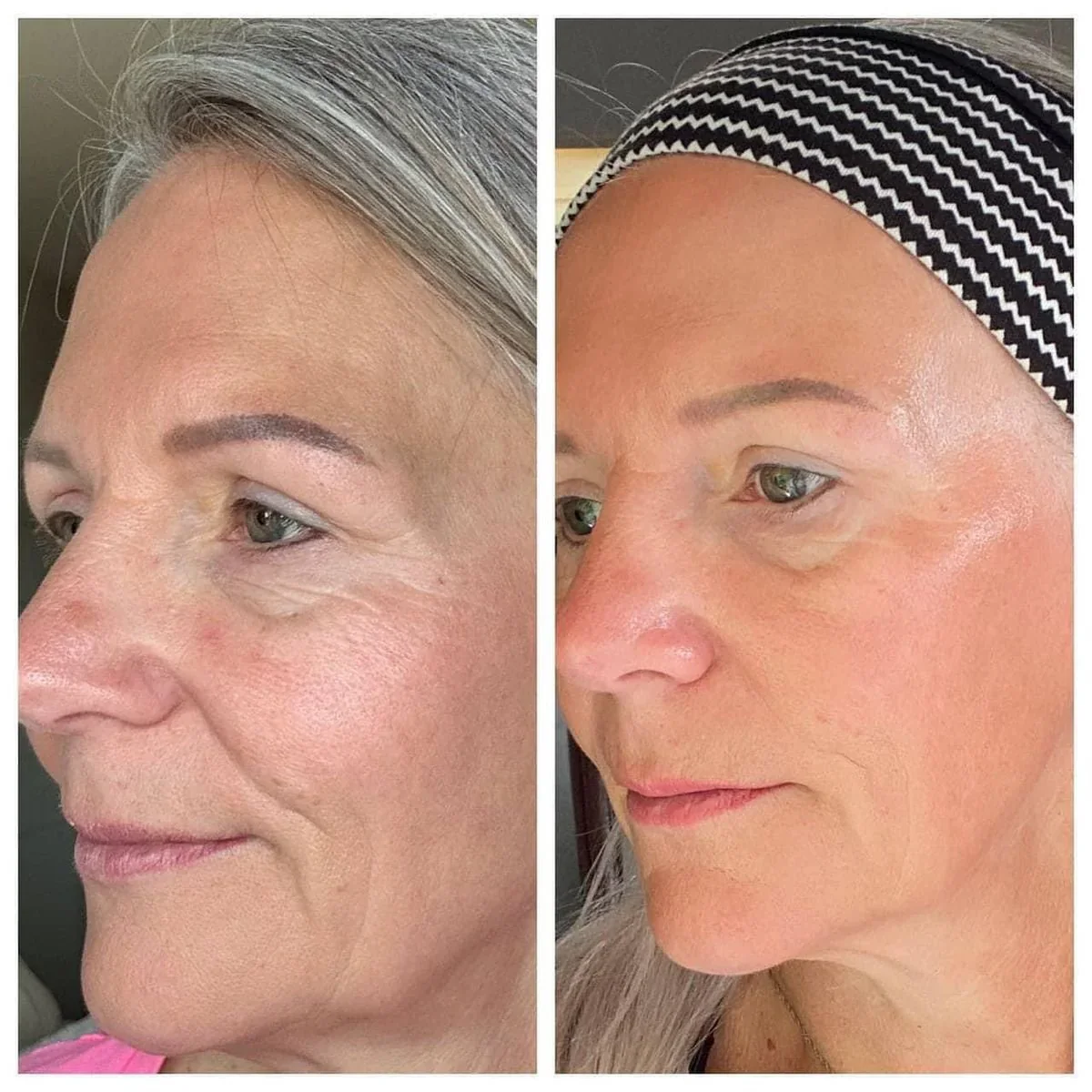 Oakline SculptBrush - Depuffs your face in 2 minutes - Image 5